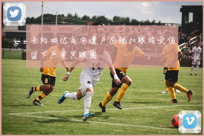卡约回忆高中遭卢尼隔扣眼睛受伤留下严重黑眼圈
